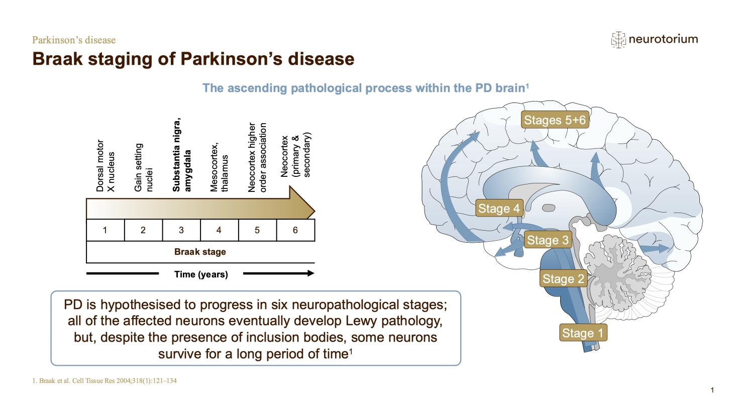 Parkinsons Disease – Neurobiology and Aetiology – slide 12